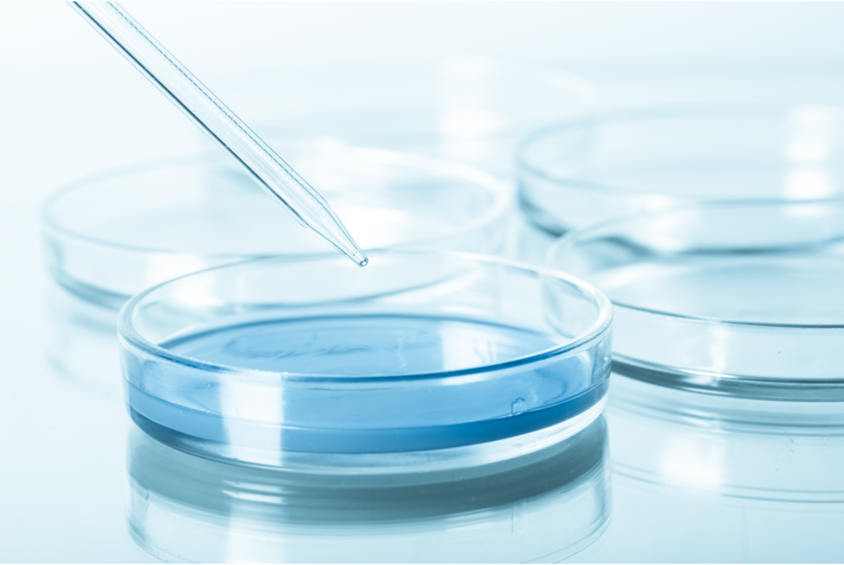 Cyrex Lymphocyte MAP Advanced AIDS Screening